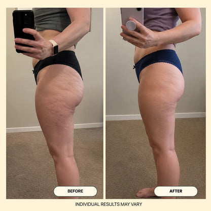 Levelle Anti-Cellulite Massage Oil